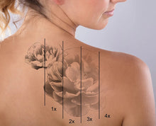 link to the tattoo removal page