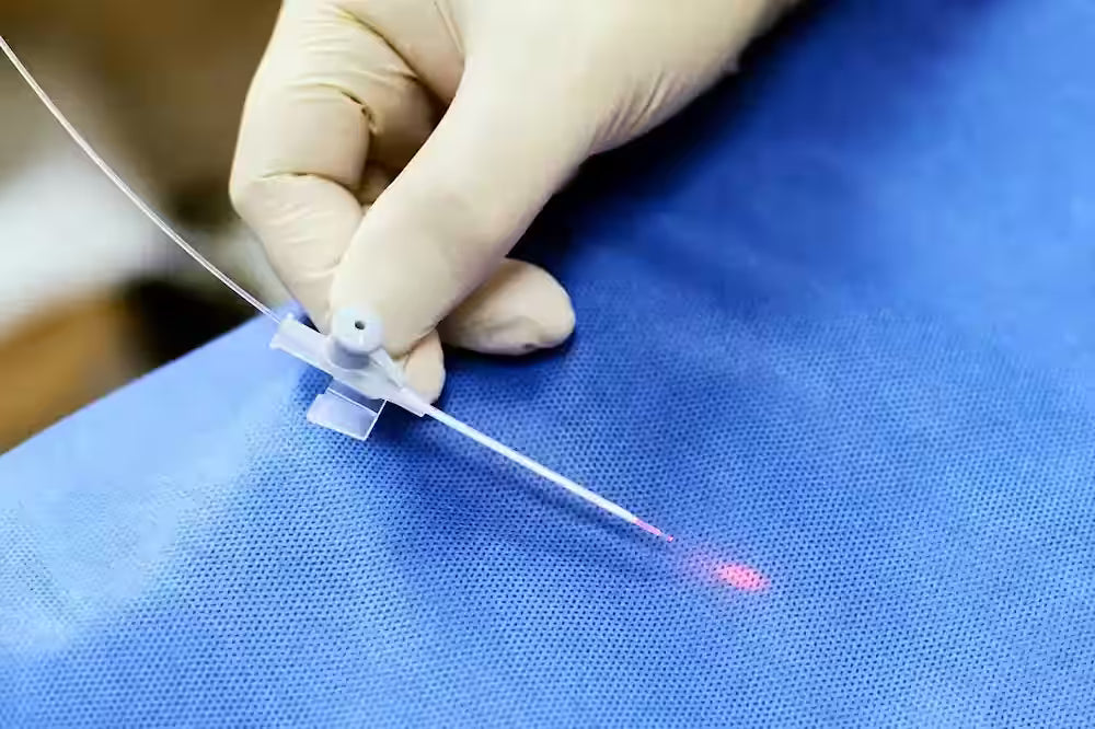example of laser fiber similar to those used in endovenous laser ablations