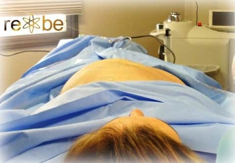 liposuction patient in the procedure with only the right side done.  