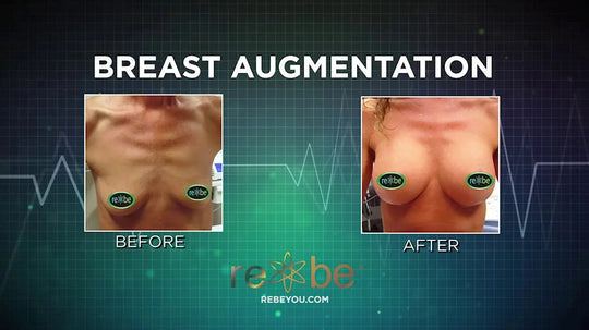 before and after front torso images of breast augmentation patient 
