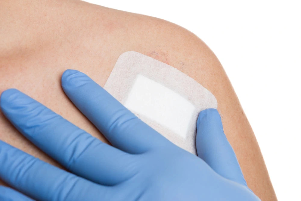 view of shoulder with bandage after mole excision