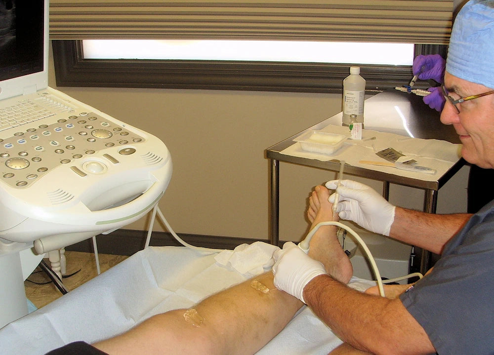 Ultrasound guided sclerotherapy of the left ankle.