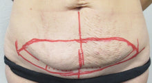 View veins page